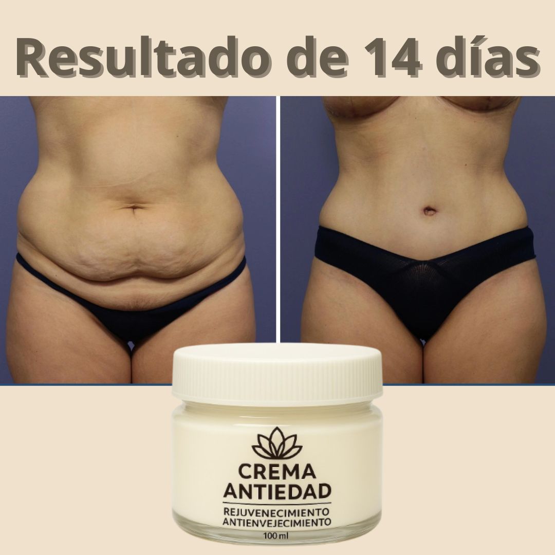 COMPRA 1 Y LLEVA 2 - Crema Rejuvenecedora y Anti-Envejecimiento - PAGUE AL RECIBIR (01)