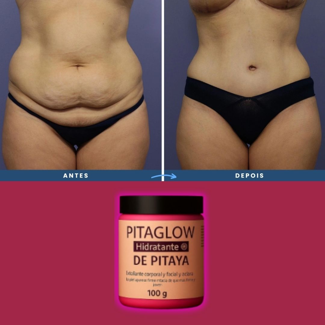 COMPRA 1 Y LLEVA 2 - Crema Pitahaya Rejuvenecedora y Anti-Envejecimiento - PAGUE AL RECIBIR