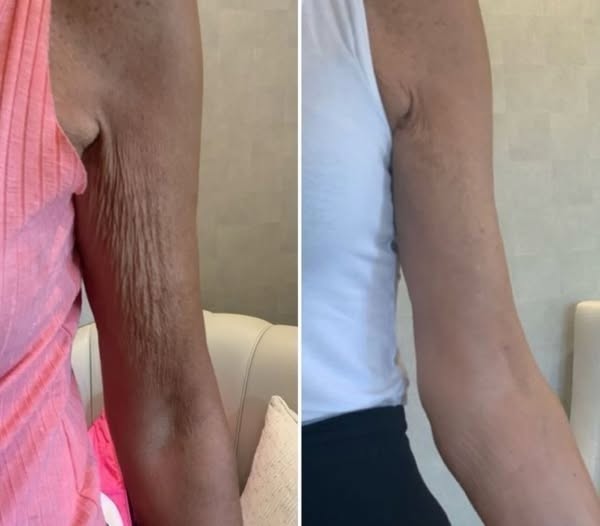 COMPRA 1 Y LLEVA 2 - Crema Pitahaya Rejuvenecedora y Anti-Envejecimiento