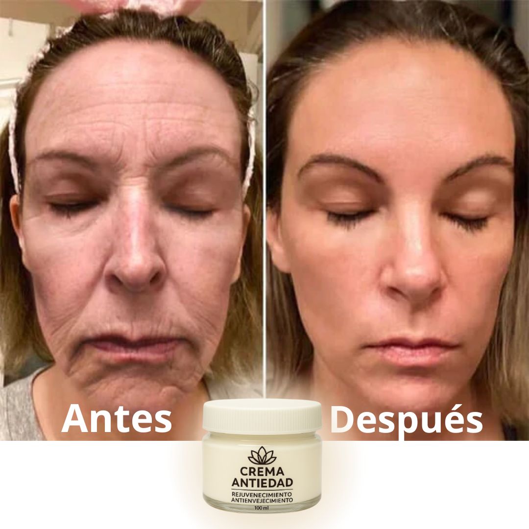 COMPRA 1 Y LLEVA 2 - Crema Rejuvenecedora y Anti-Envejecimiento - PAGUE AL RECIBIR (01)